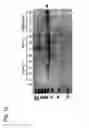 Fig. 14 - Identification of tumor-associated cell surface antigens for diagnosis and therapy