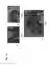 Fig. 16 - Identification of tumor-associated cell surface antigens for diagnosis and therapy