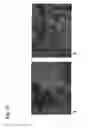 Fig. 17 - Identification of tumor-associated cell surface antigens for diagnosis and therapy