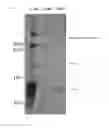 Fig. 02 - METHOD FOR EVALUATING SALIVARY ADIPONECTIN LEVEL AND KIT FOR MEASURING SALIVARY ADIPONECTIN LEVEL