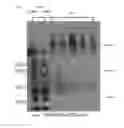 Fig. 03 - METHOD FOR EVALUATING SALIVARY ADIPONECTIN LEVEL AND KIT FOR MEASURING SALIVARY ADIPONECTIN LEVEL