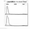 Fig. 07 - METHOD FOR EVALUATING SALIVARY ADIPONECTIN LEVEL AND KIT FOR MEASURING SALIVARY ADIPONECTIN LEVEL