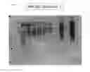 Fig. 10 - METHOD FOR EVALUATING SALIVARY ADIPONECTIN LEVEL AND KIT FOR MEASURING SALIVARY ADIPONECTIN LEVEL