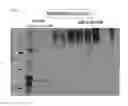 Fig. 11 - METHOD FOR EVALUATING SALIVARY ADIPONECTIN LEVEL AND KIT FOR MEASURING SALIVARY ADIPONECTIN LEVEL