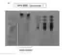 Fig. 12 - METHOD FOR EVALUATING SALIVARY ADIPONECTIN LEVEL AND KIT FOR MEASURING SALIVARY ADIPONECTIN LEVEL