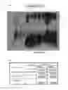 Fig. 13 - METHOD FOR EVALUATING SALIVARY ADIPONECTIN LEVEL AND KIT FOR MEASURING SALIVARY ADIPONECTIN LEVEL