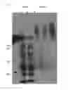 Fig. 15 - METHOD FOR EVALUATING SALIVARY ADIPONECTIN LEVEL AND KIT FOR MEASURING SALIVARY ADIPONECTIN LEVEL