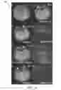 Fig. 07 - MRI using spatially adaptive regularization for image reconstruction
