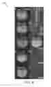 Fig. 10 - MRI using spatially adaptive regularization for image reconstruction