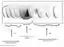 Fig. 01 - Blue light filter lenses