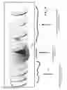 Fig. 06 - Blue light filter lenses