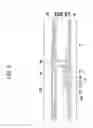 Fig. 10 - LIQUID CRYSTAL DISPLAY