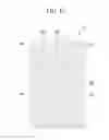 Fig. 13 - Liquid crystal display