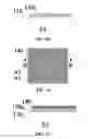 Fig. 04 - Touch panel and method for forming a touch structure