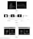 Fig. 04 - Three-Dimensional Face Recognition Device Based on Three Dimensional Point Cloud and Three-Dimensional Face Recognition Method Based on Three-Dimensional Point Cloud