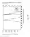 Fig. 05 - Magnetic resonance imaging white matter hyperintensities region recognizing method and system
