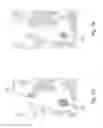 Fig. 06 - Magnetic resonance imaging white matter hyperintensities region recognizing method and system