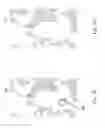 Fig. 07 - Magnetic resonance imaging white matter hyperintensities region recognizing method and system
