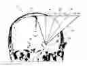 Fig. 01 - Method for determining at least one applicable path of movement for an object in tissue