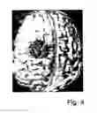Fig. 05 - Method for determining at least one applicable path of movement for an object in tissue