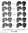 Fig. 34 - Methods and systems for producing an implant