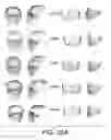 Fig. 35 - Methods and systems for producing an implant