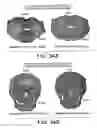 Fig. 37 - Methods and systems for producing an implant