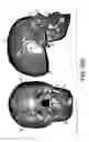 Fig. 42 - Methods and systems for producing an implant