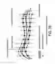 Fig. 44 - Methods and systems for producing an implant