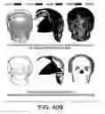 Fig. 46 - Methods and systems for producing an implant