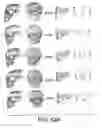 Fig. 49 - Methods and systems for producing an implant