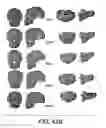 Fig. 50 - Methods and systems for producing an implant