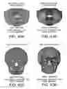 Fig. 51 - Methods and systems for producing an implant