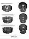 Fig. 52 - Methods and systems for producing an implant