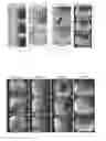 Fig. 06 - Image processing method and apparatus for tracking a site in a series of images