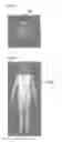 Fig. 03 - Method and device for processing virtual fitting model image