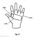 Fig. 10 - Personal Protection Device