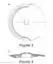 Fig. 03 - Electronic Cymbal With Multiple Detection Zones