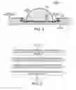 Fig. 03 - Packaging a substrate with an LED into an interconnect structure only through top side landing pads on the substrate