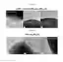 Fig. 09 - Cathode material for lithium secondary battery, and lithium secondary battery containing same