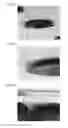 Fig. 06 - PERFORATED PLATE-SHAPED MATERIAL AND METHOD OF MANUFACTURING THE SAME