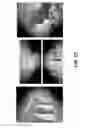 Fig. 13 - Multi-camera system using folded optics free from parallax and tilt artifacts