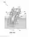 Fig. 19 - Prosthesis adapter