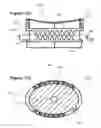 Fig. 22 - Modular in line button drip emitter system