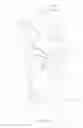 Fig. 11 - Dog Droppings Catcher