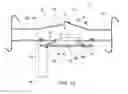 Fig. 08 - Garment having extensible sleeves