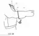 Fig. 16 - Garment having extensible sleeves