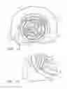 Fig. 10 - Reel based lacing system