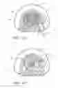 Fig. 30 - Reel based lacing system