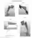Fig. 01 - Edge Comb